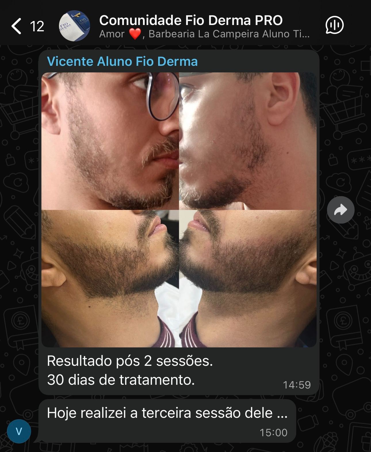 Resultado pós 2 sessões
